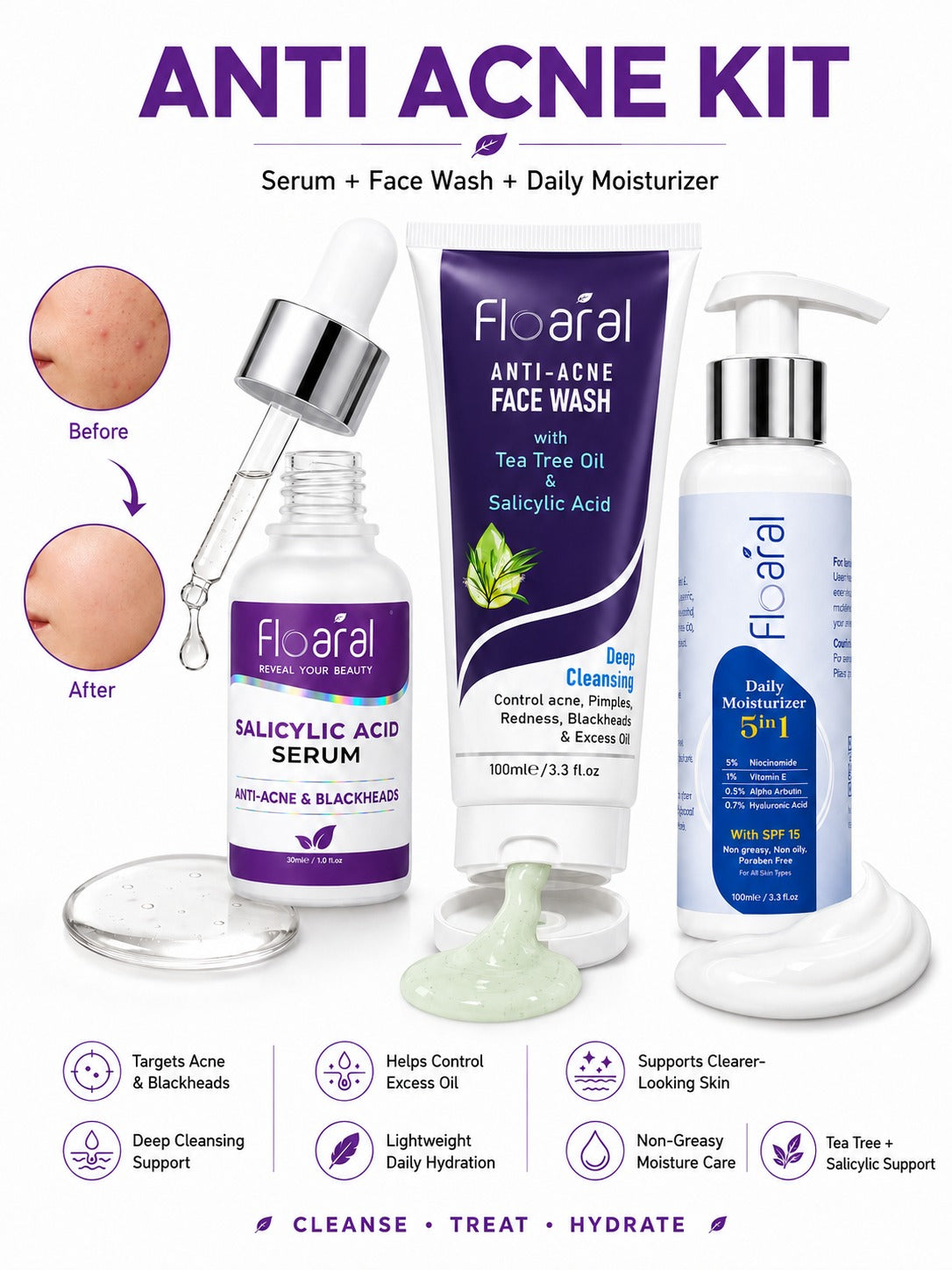Anti-Acne Kit